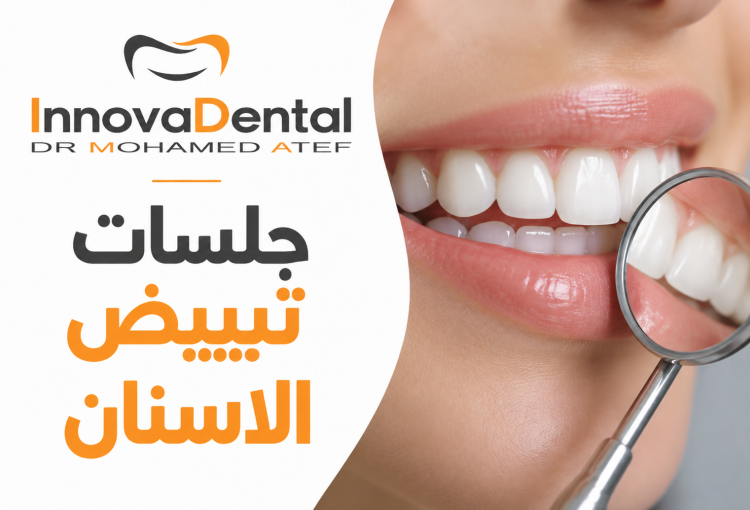 Best Teeth Whitening in Egypt